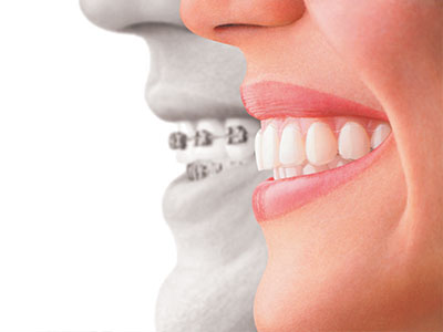 Twin City Dentistry | Digital Radiography, Dental Fillings and Teeth Whitening
